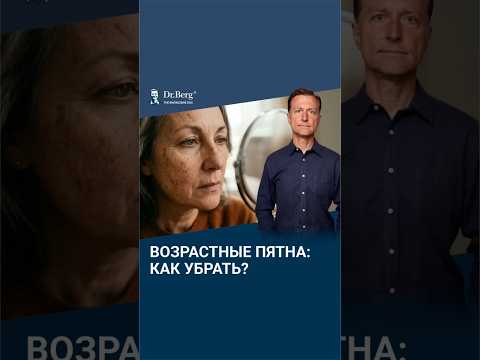 Как избавиться от пигментных пятен навсегда?