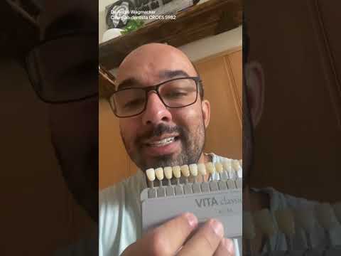 Cor dos Dentes Clareamento Faceta #odonto #saúde #dentista