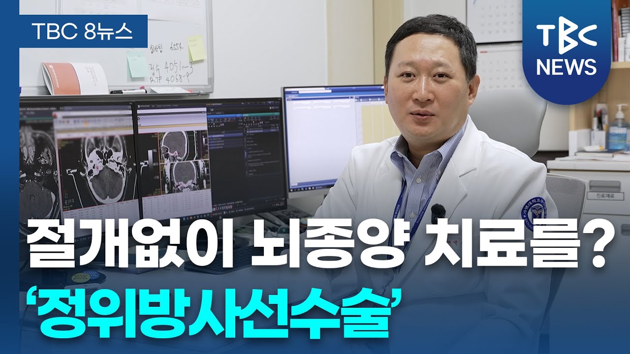 ‘정위방사선수술’ 절개 없이 뇌종양 치료ㅣ방사선종양학과 박승규 교수 관련사진