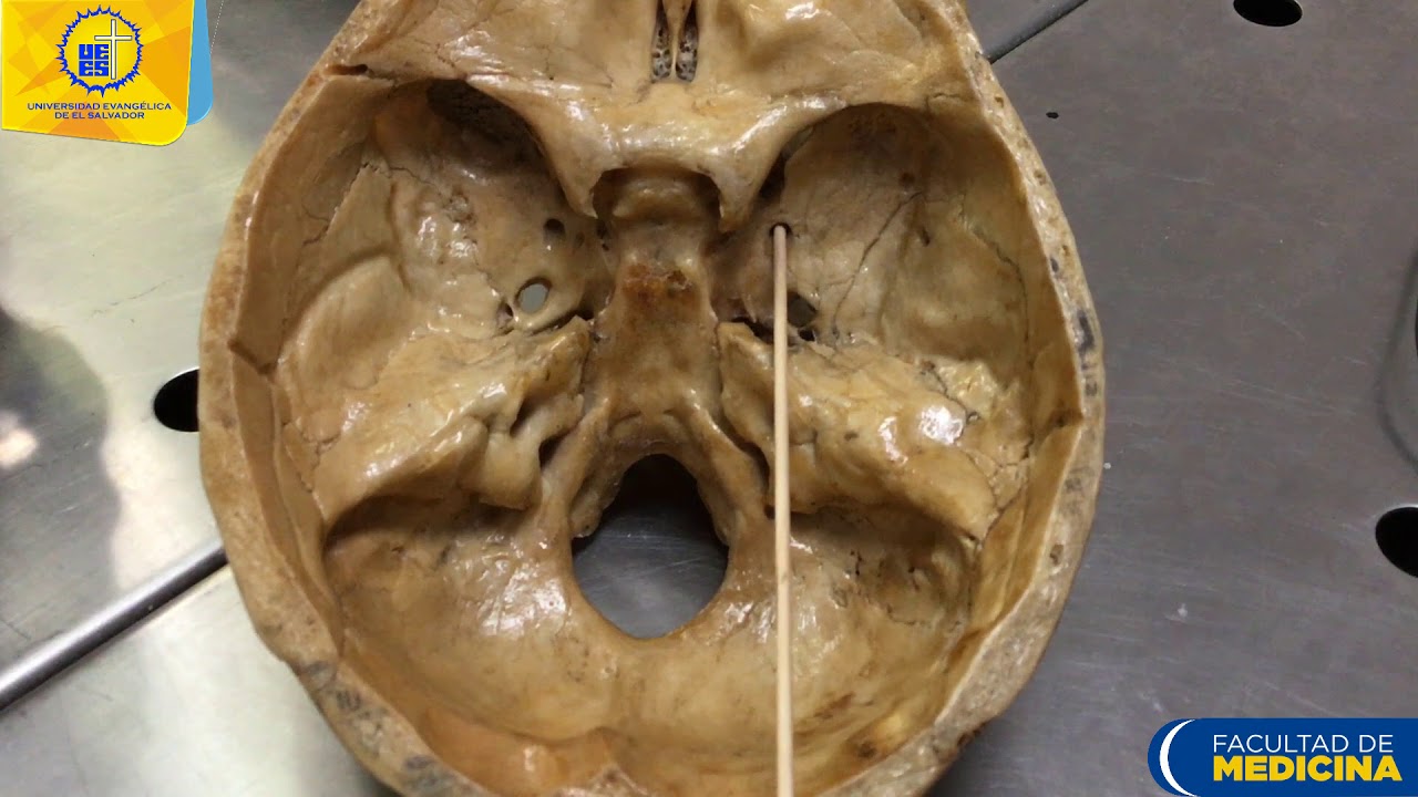 Agujeros de la base del craneo - Dr. Ernesto Hurtado