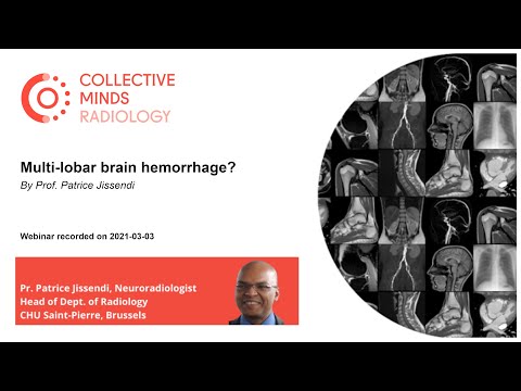Webinar: Multi-lobar brain hemorrhage?