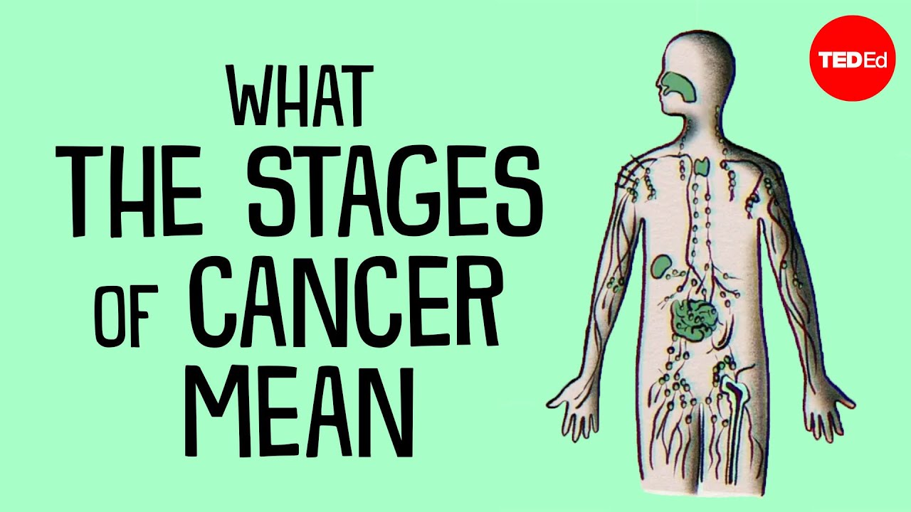 How do doctors determine what stage of cancer you have? - Hyunsoo Joshua No and Trudy Wu