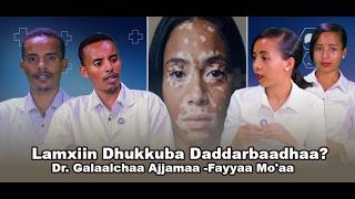 Lamxiin Dhukkuba Daddarbaadhaa? Dr Galaalchaa Ajjamaa-Fayyaa Mo'aa