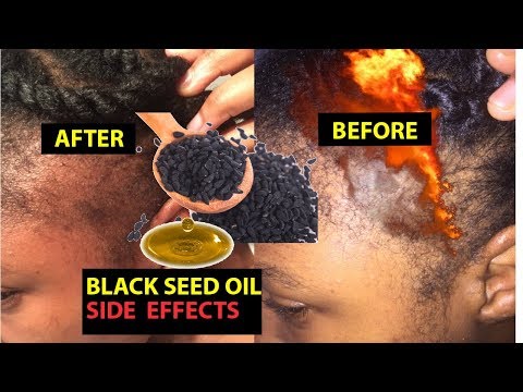 How to Use Black Seed Oil for Hair Growth (And Prevent...