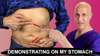 Stop Bloating & Constipation in 2 Moves (Demonstrating My Stomach)  Dr. Mandell