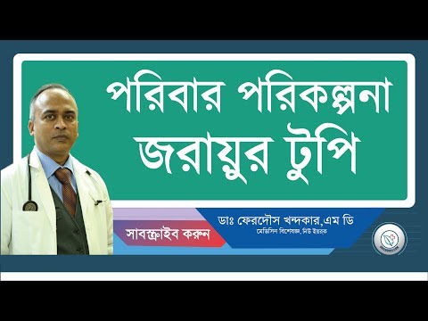 পরিবার পরিকল্পনা/জরায়ু টুপি।