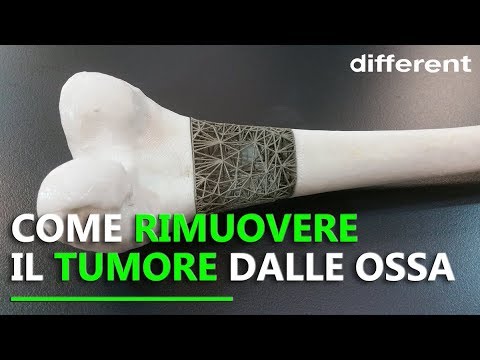 23 settimane di gravidanza mal di schiena tanto Quali danni i menischi del ginocchio