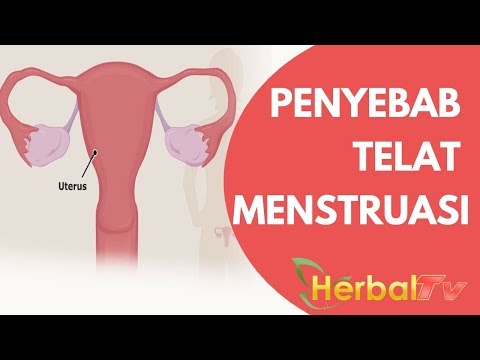 Berapa banyak adalah operasi untuk meningkatkan penis Bagaimana untuk memperbesar penis Anda tanpa resep