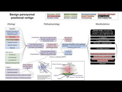 Benign paroxysmal positional vertigo (BPPV) (mechanism of disease)