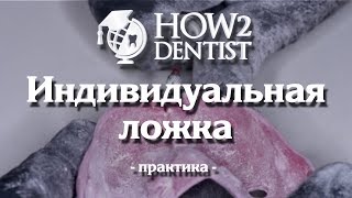 Индивидуальная оттискная ложка понятие показания к ее применению