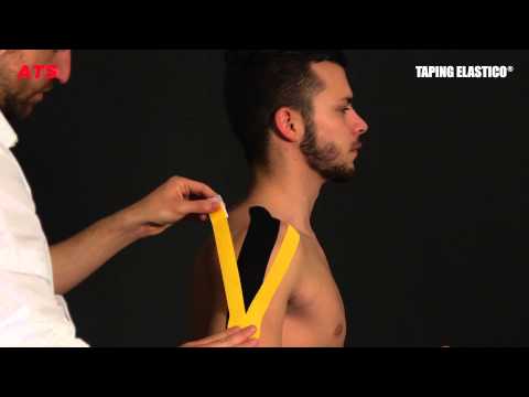 Mal di schiena quando si tossisce su un lato Ginnastica trattamento osteocondrosi cervicale