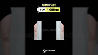 다리 길어보이는 이유, 허벅지 라인이었네 🪄