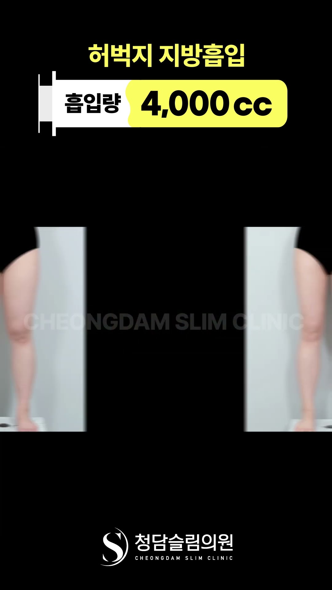 다리 길어보이는 이유, 허벅지 라인이었네 🪄