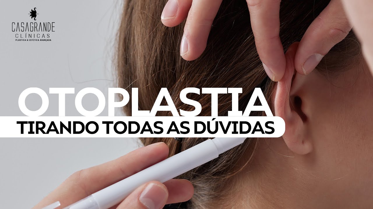 Respondendo as principais dúvidas sobre OTOPLASTIA