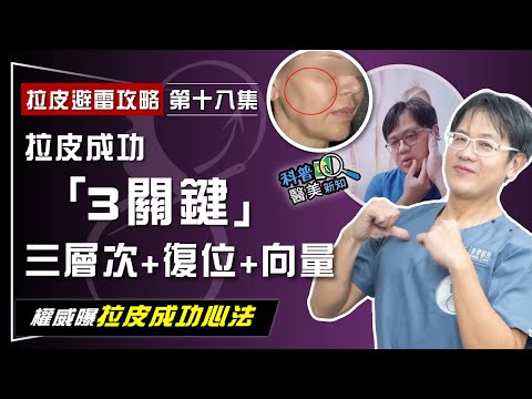【拉皮避雷攻略|第十八集】拉皮手術只拉"皮" 沒變年輕 反成詭異僵臉! 三層次、復位、向量拉皮成功「3大祕訣」完整公開