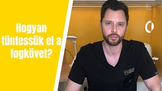 Hogyan tüntessük el a fogkövet?