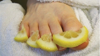 This Will DESTROY Toenail Fungus For Good!