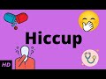 Hiccup, Causes, Signs and Symptoms, Diagnosis and Treatment.