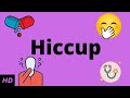 Hiccup Causes Signs And Symptoms Diagnosis And Treatment