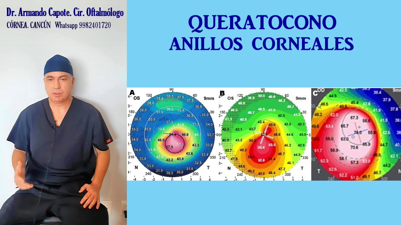 Armando Capote Cabrera-13