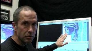 Tips #4: Topical Anesthesia