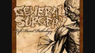 General Surgery - Mortuary Wars