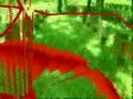 LSD effects 