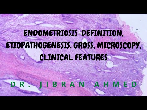 ENDOMETRIAL CARCINOMA II FEMALE GENITAL TRACT II ROBBINS 10TH E II PATHOLOGY LECTURE