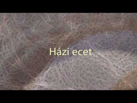 lehet-e hőmérséklet a visszértágulatoktól