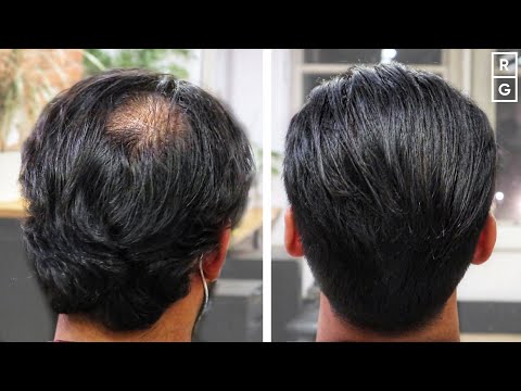 Great Haircut For Thinning Hair At The Back *NO...