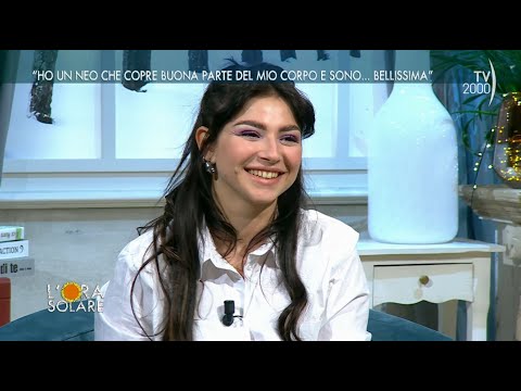 L'Ora Solare (Tv2000) - "Ho un neo che copre buona parte del mio corpo e sono... bellissima"