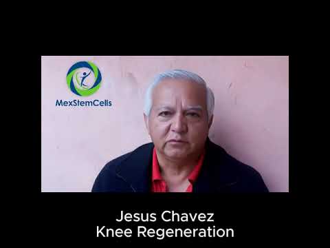 Stem Cell Knee Regeneration in Mexico City, Mexico – Costs, Clinics, and Care