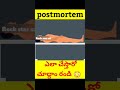 Postmortem ఎలా చేస్తారో చూద్దాం రండి Let S See How Postm
