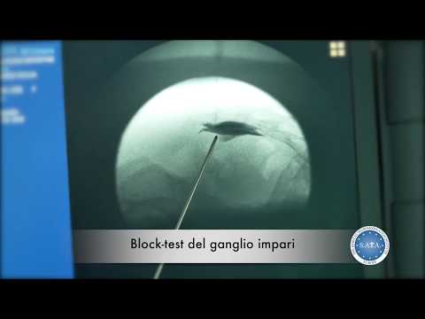 Ha spuntato ginocchio e fece un passo indietro Esercizi gratuiti per toracica