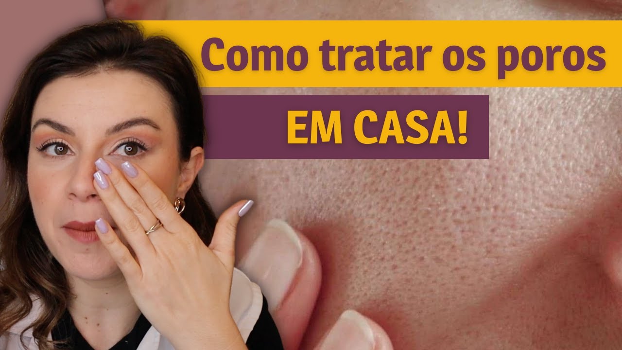 Como tratar os poros dilatados em casa! Dica de Esteticista