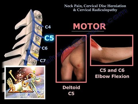 Neck Pain, Cervical Disc Herniation & Radiculopathy-Everything You Need To Know - Dr. Nabil Ebraheim