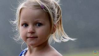 10 Birthmarks You Won't Believe Actually Exist