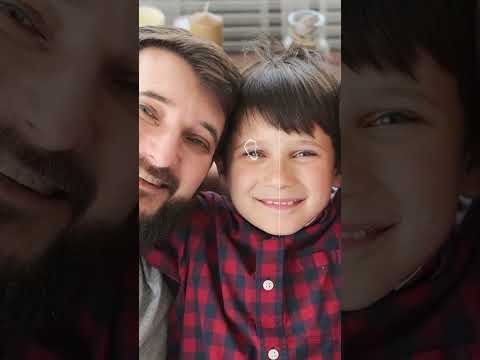 From $500k Surgery to $0 Bill: My Private Health Insurance Story 🏥💰✅  #healthinsurance