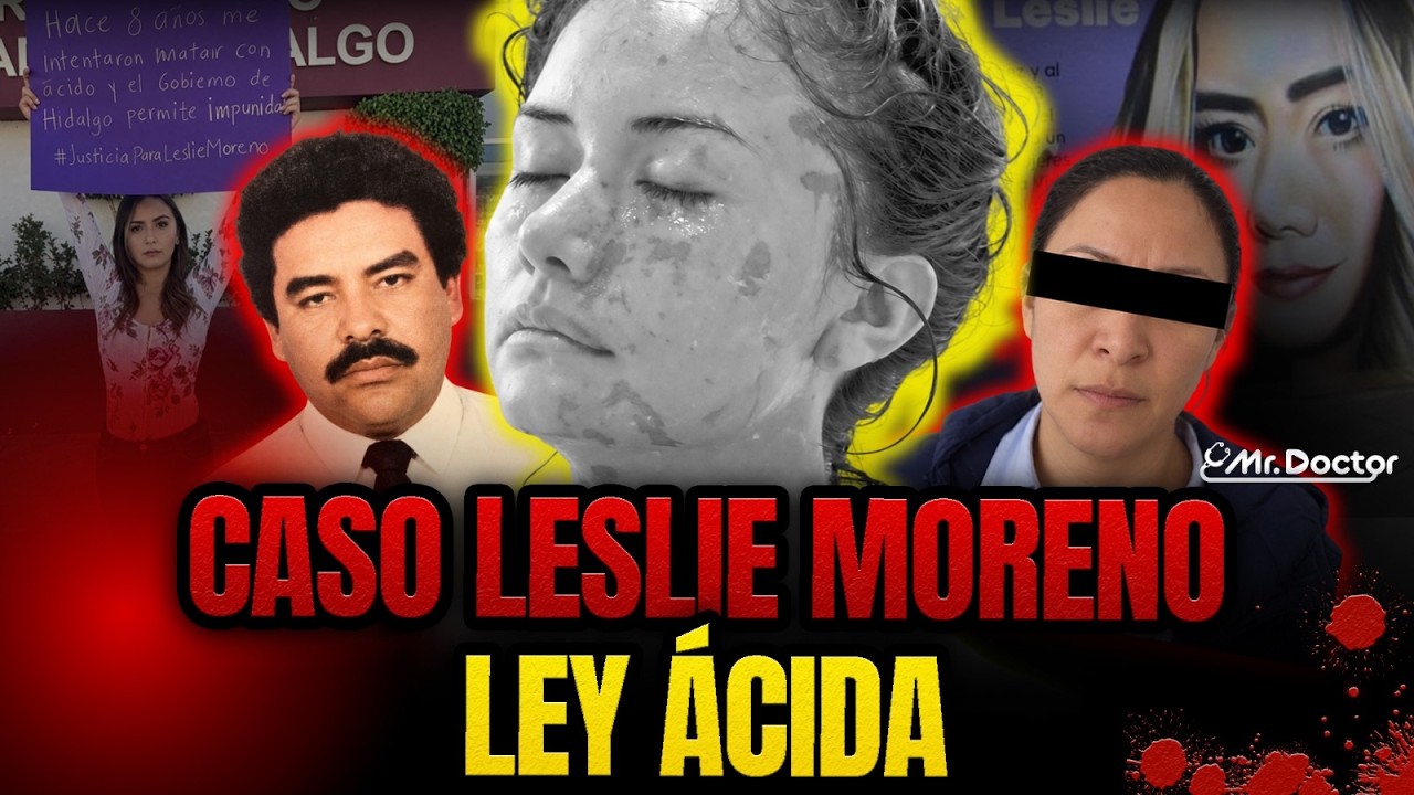 👉🏼 Me QUEM4R0N con ÁCIDO MURIÁTICO, me QUERÍAN M4T4R: Leslie Moreno | #Diagnóstico 201 | Mr Doctor