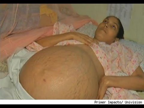 Video nakapagpapagaling Sytina saloobin para sa pagbaba ng timbang Ay posible na mawalan ng timbang sa tulong ng isang labatiba