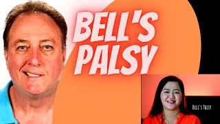 Understanding Bell's Palsy, How Physical Therapy can treat facial paralysis | Doc Cherry: video