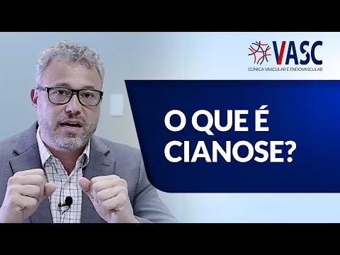 O que é a cianose?