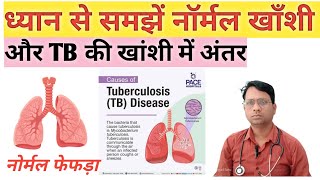 ध्यान से समझें नॉर्मल खाँशी और TB की खांसी में अंतर#khanshi