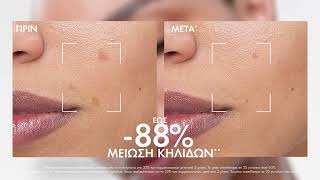 Νέο πρωτόκολλο Liftactiv Pigment Specialist B3| Vichy Greece