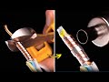 Simple and Useful Repair Tips that Work Extremely Well