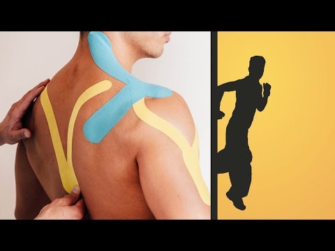 Genick gebrochen und verletzt Salbe in der zervikalen thorakalen Osteochondrose Video