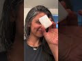 Dark Underarms Try This Chemical Free Solution Pigmentation Pigmentationremedy Underarms