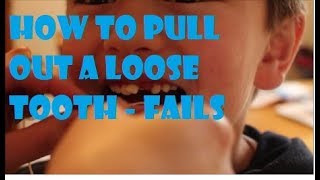 How to Pull Out a Loose Tooth - Fails!   ||  mrcreativequarter