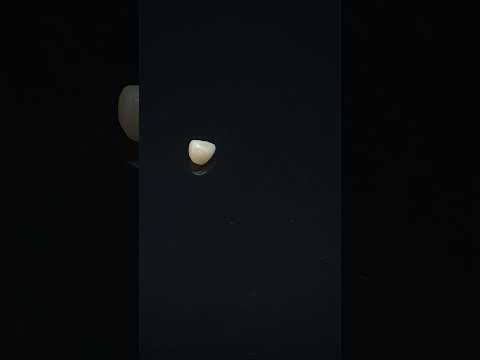 YouTube 썸네일