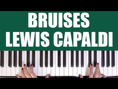 download lagu mp3 mp4 Bruises Lewis Capaldi Accordi, download lagu Bruises Lewis Capaldi Accordi gratis, unduh video klip Bruises Lewis Capaldi Accordi
